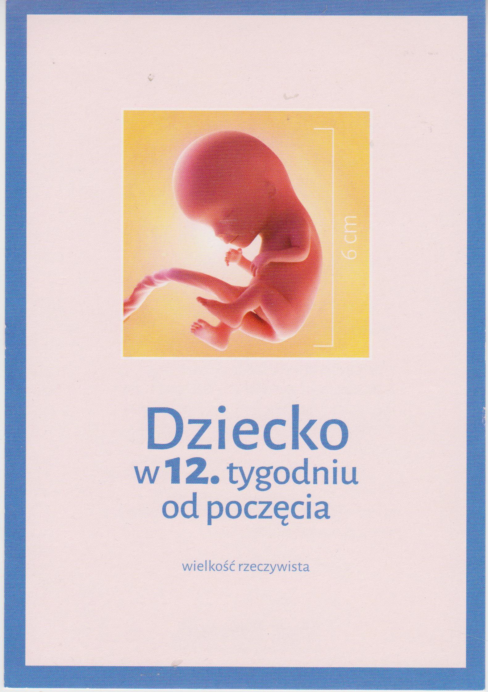 Dzecko 12 tyg.